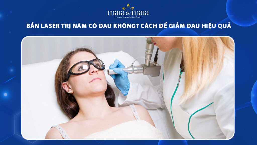 bắn laser trị nám có đau không