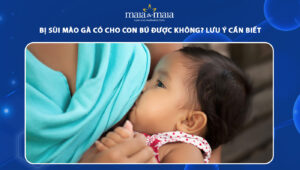 bị sùi mào gà có cho con bú được không