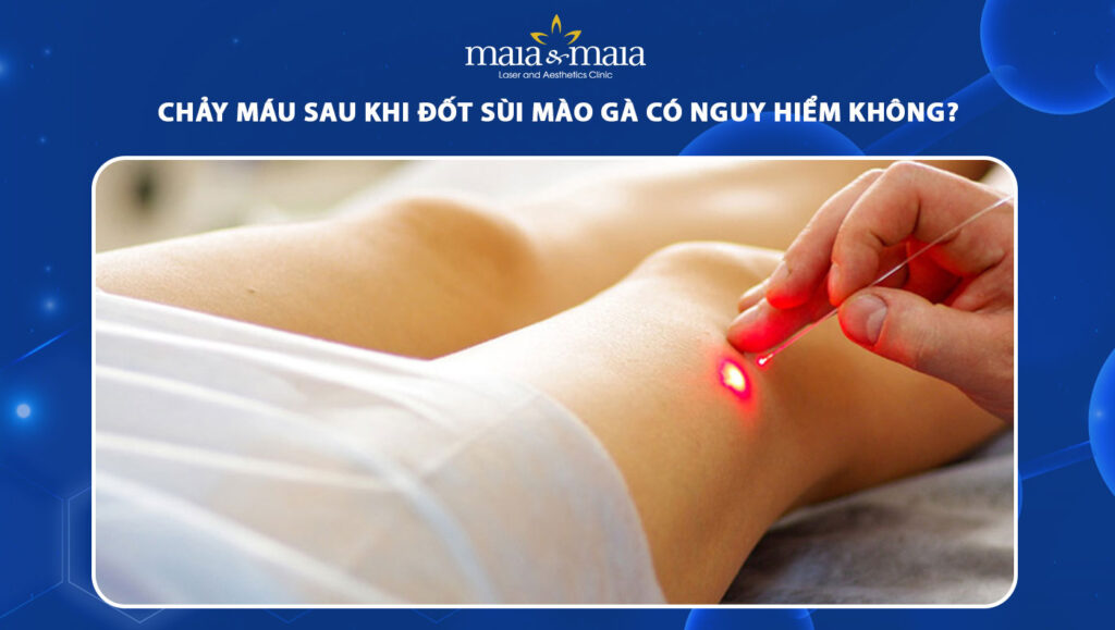 chảy máu sau khi đốt sùi mào gà