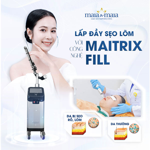 công nghệ maitrix fill tại maia