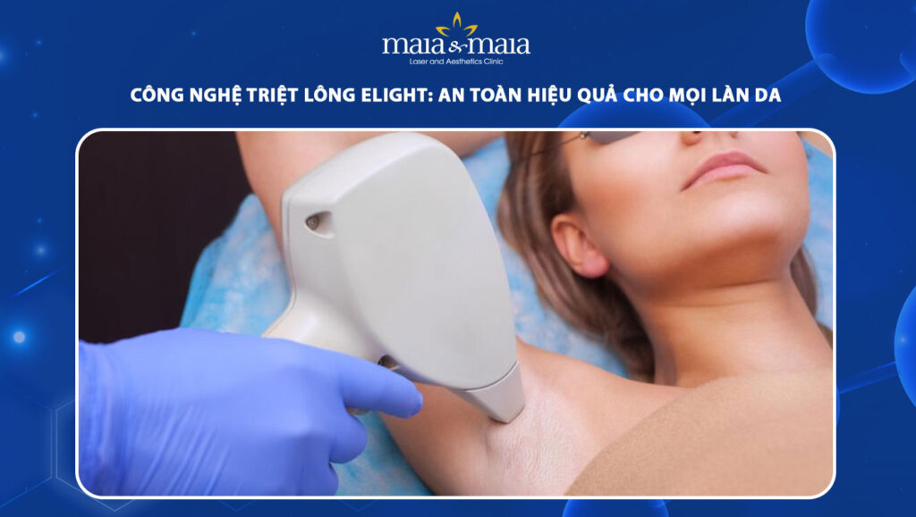 công nghệ triệt lông Elight