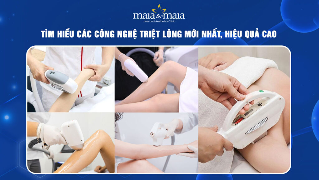 công nghệ triệt lông mới nhất