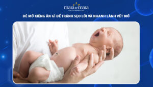 đẻ mổ kiêng ăn gì để tránh sẹo lồi