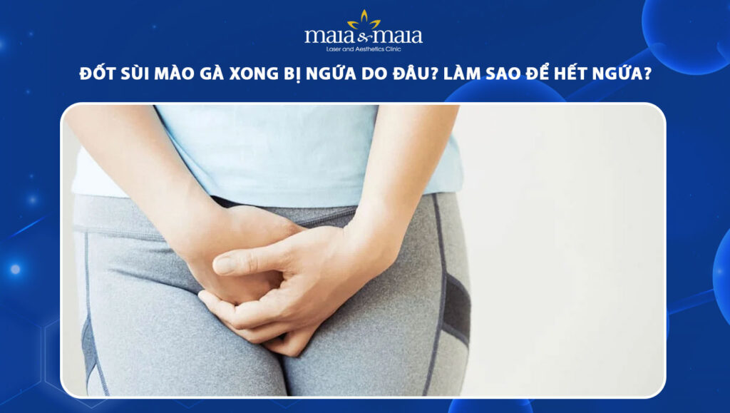 đốt sùi mào gà xong bị ngứa