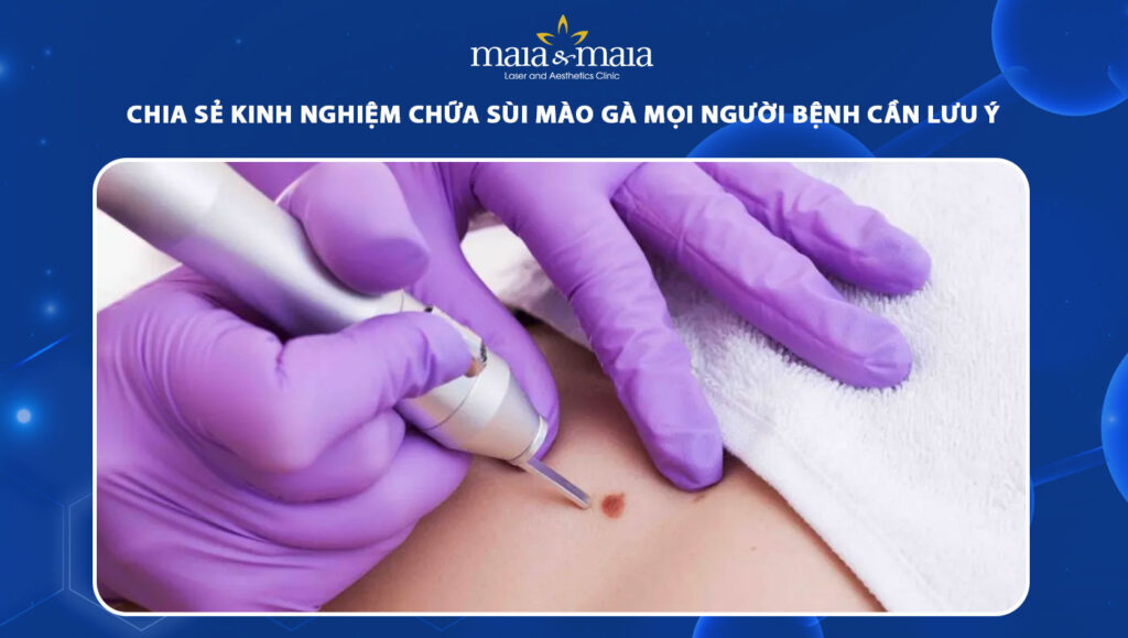 Kinh nghiệm chữa sùi mào gà