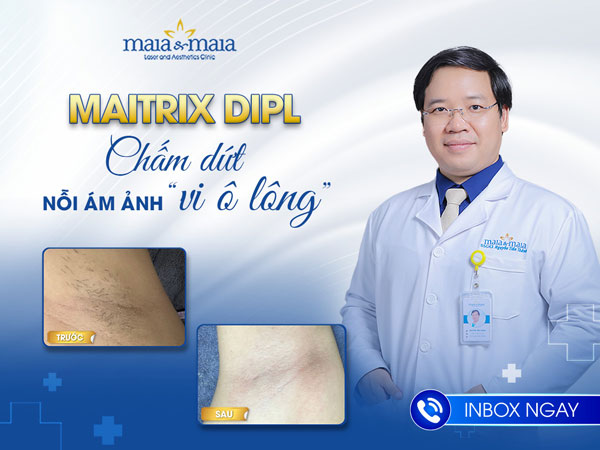 kỹ thuật triệt lông Maitrix DiPL