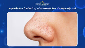 mun dau den o mui thum