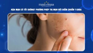 nặn mụn có tốt không