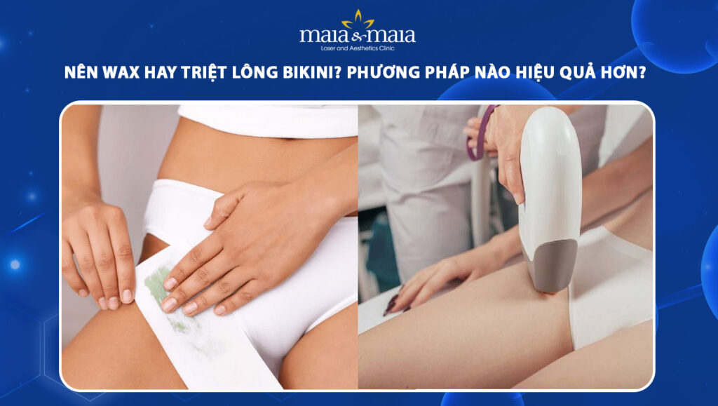 nên wax hay triệt lông bikini