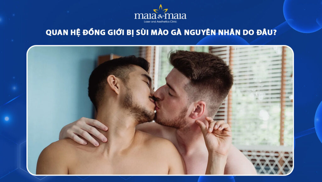 Quan hệ đồng giới bị sùi mào gà nguyên nhân do đâu? Khi nào cần gặp bác sĩ 1 quan hệ đồng giới bị sùi mào gà