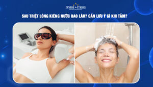 sau triệt lông kiêng nước bao lâu