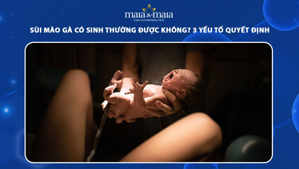 sùi mào gà có sinh thường được không