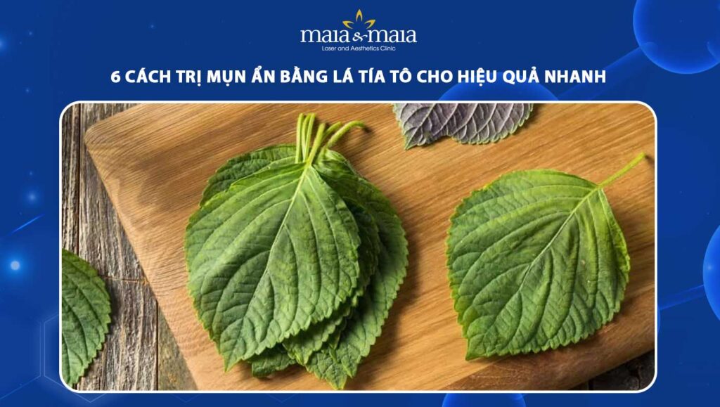 trị mụn ẩn bằng lá tía tô