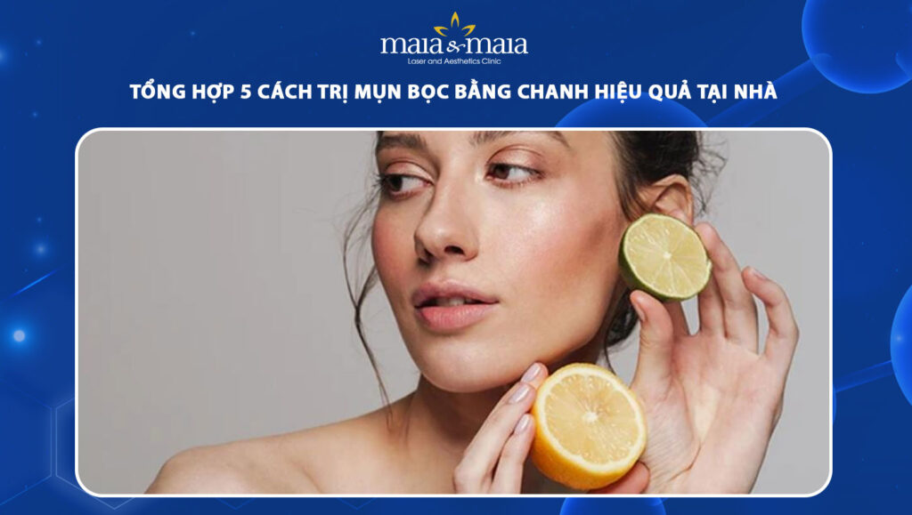 trị mụn bọc bằng chanh