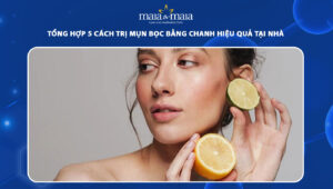 trị mụn bọc bằng chanh