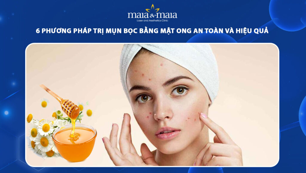trị mụn bọc bằng mật ong
