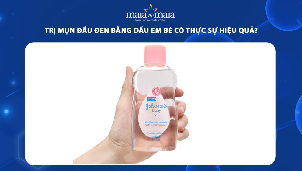 trị mụn đầu đen bằng dầu em bé