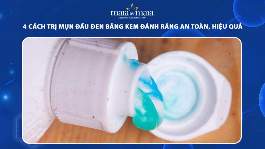 trị mụn đầu đen bằng kem đánh răng