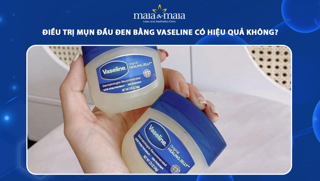 trị mụn đầu đen bằng vaseline