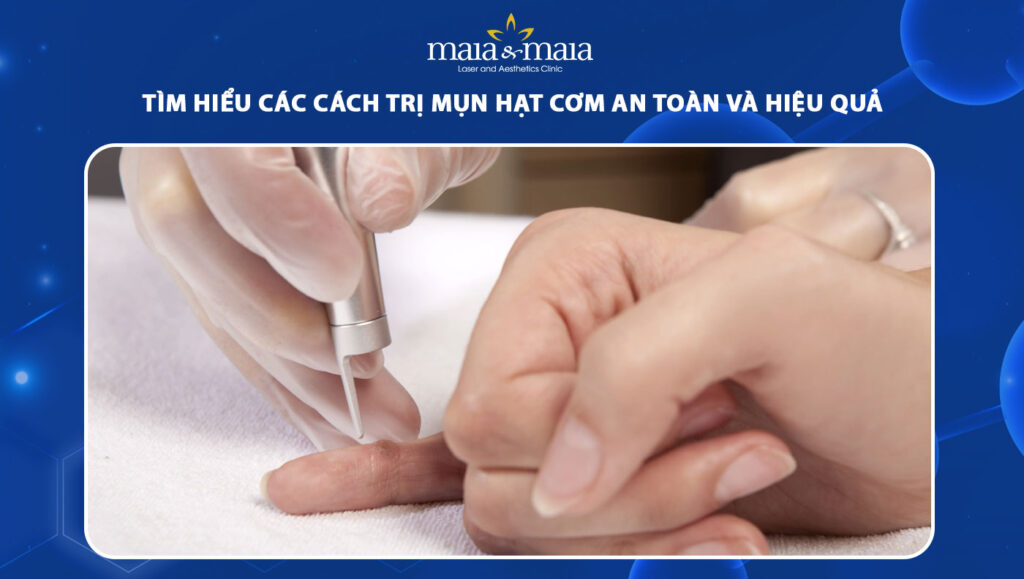 trị mụn hạt cơm