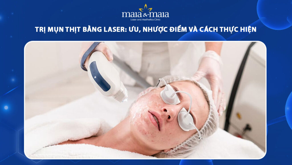 Trị mụn thịt bằng laser