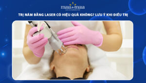 tri nam bang laser co hieu qua khong