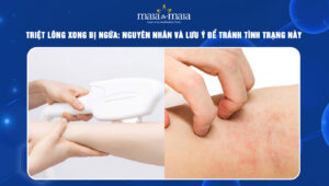 triệt lông xong bị ngứa