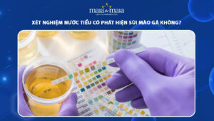 Xét nghiệm nước tiểu có phát hiện sùi mào gà không