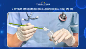 xét nghiệm sùi mào gà