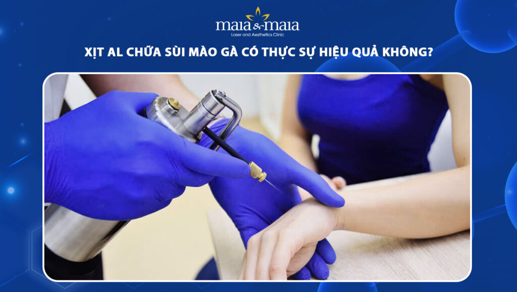 xịt AL chữa sùi mào gà