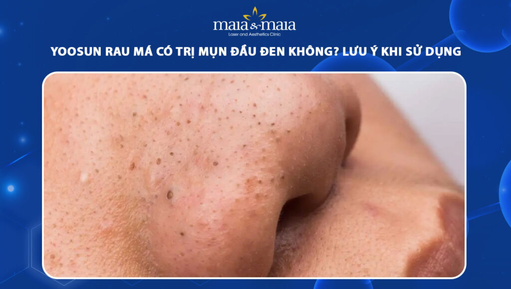 yoosun rau má có trị mụn đầu đen không