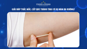 Cấy que tránh thai có bị nám da không