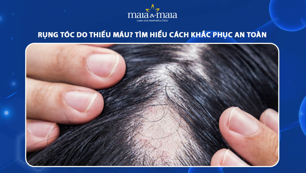 Rụng tóc do thiếu máu là như nào? Cách khắc phục an toàn 1 Rụng tóc do thiếu máu