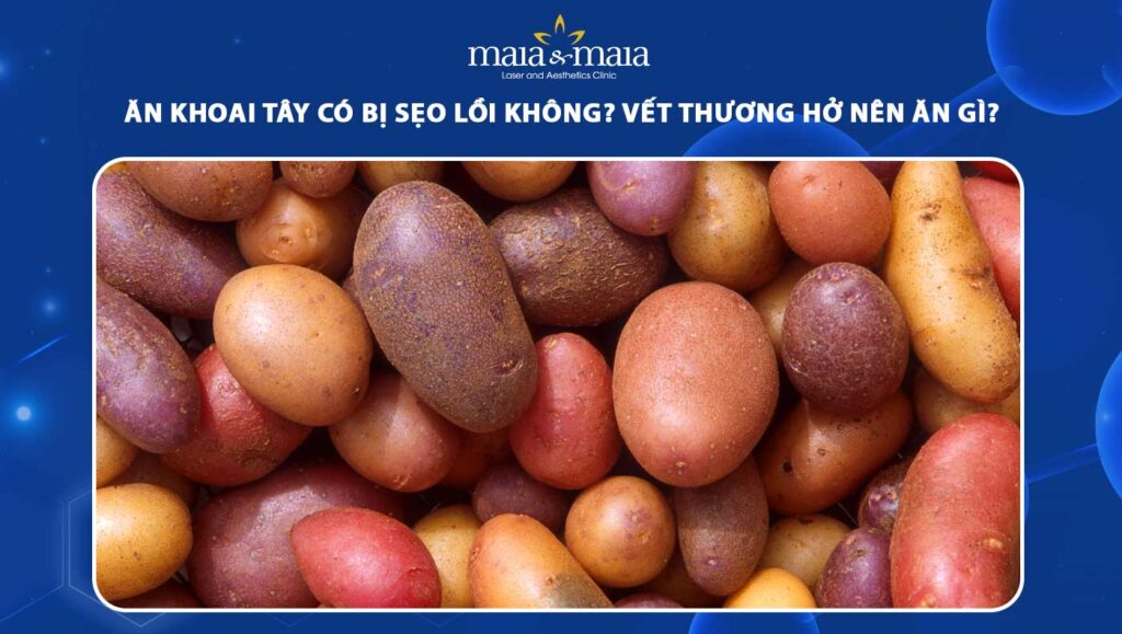 ăn khoai tây có bị sẹo lồi không