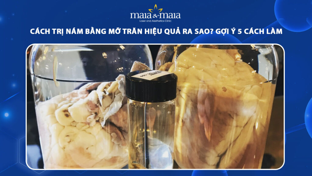 cách trị nám bằng mỡ trăn