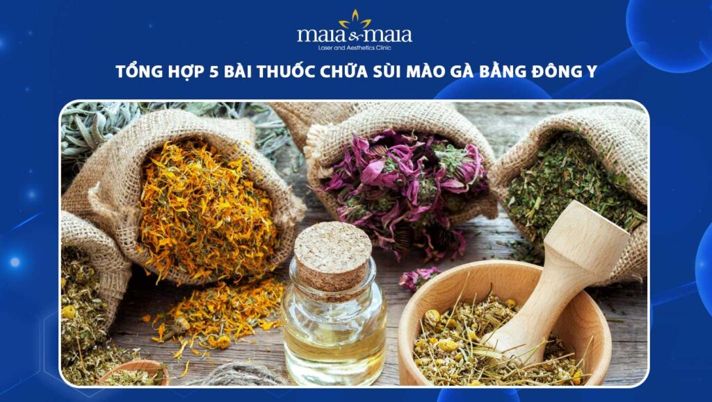 chữa sùi mào gà bằng đông y