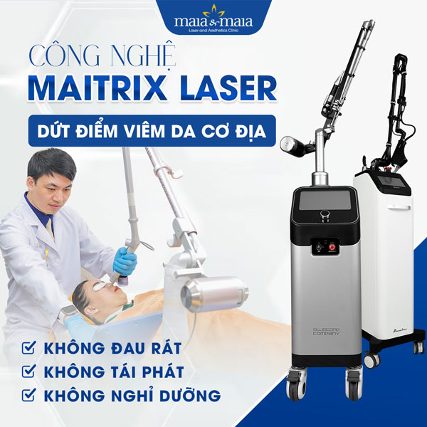 công nghệ maitrix laser