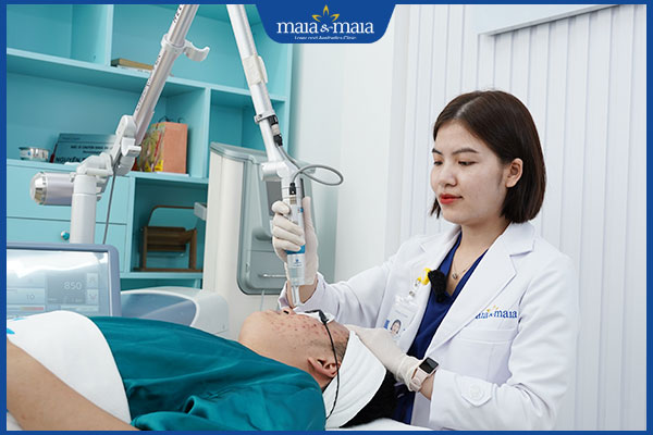 loại bỏ mụn đầu đen bằng laser