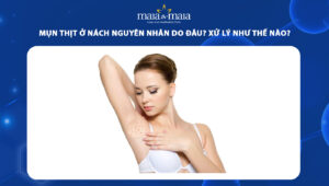 mụn thịt ở nách