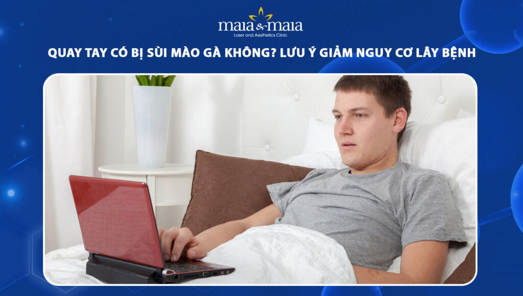 quay tay có bị sùi mào gà không