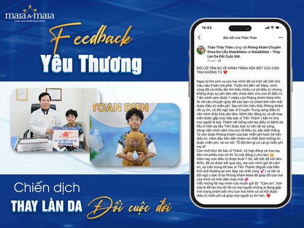 review fb điều trị bớt