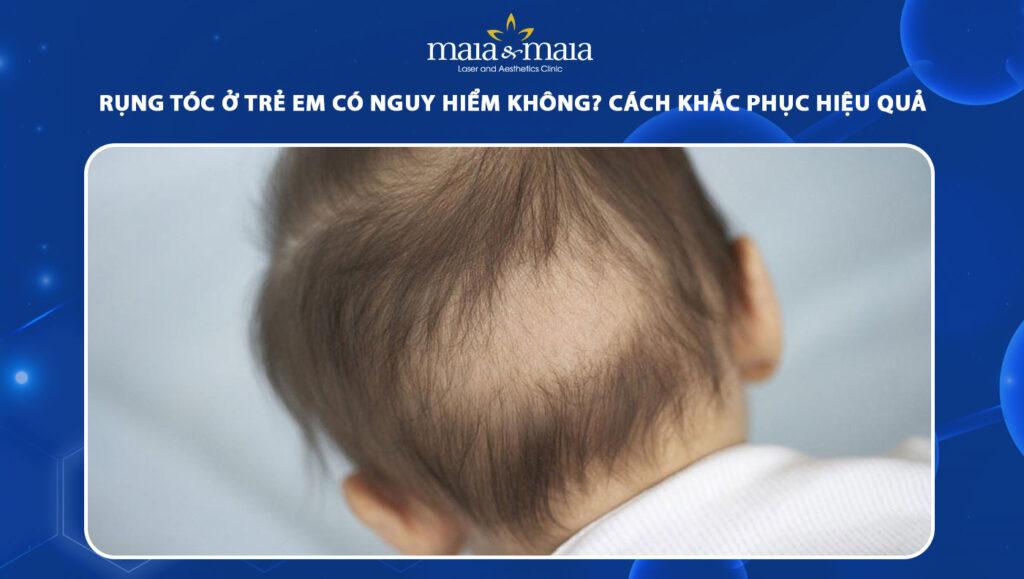 rụng tóc ở trẻ em