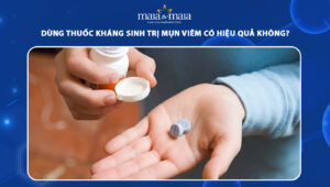 thuốc kháng sinh trị mụn viêm