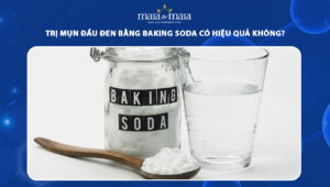 trị mụn đầu đen bằng baking soda