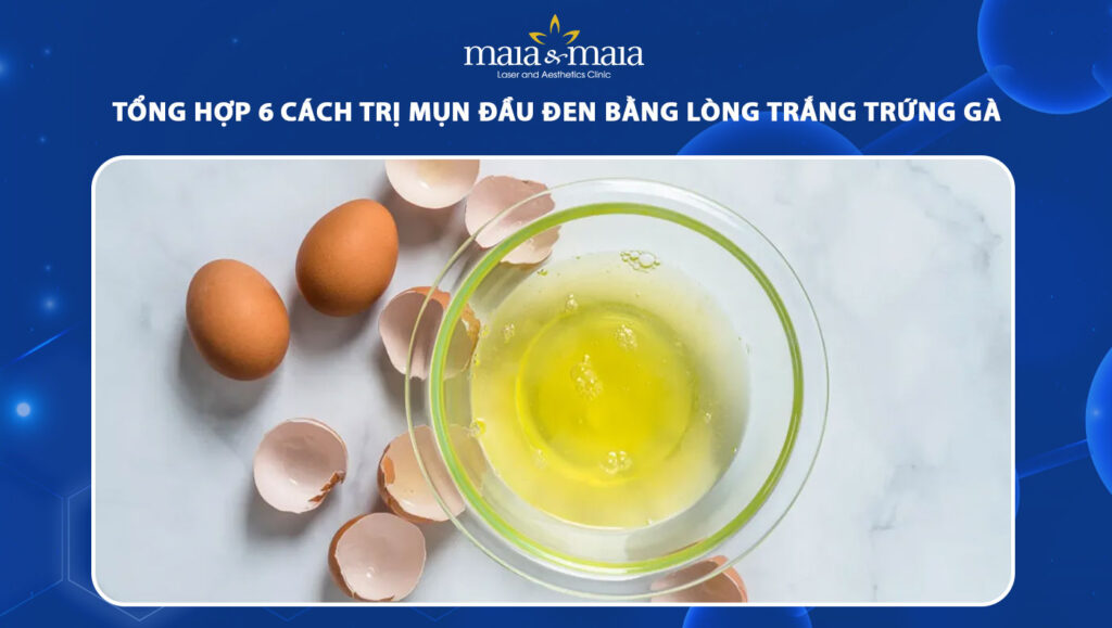 trị mụn đầu đen bằng lòng trắng trứng gà