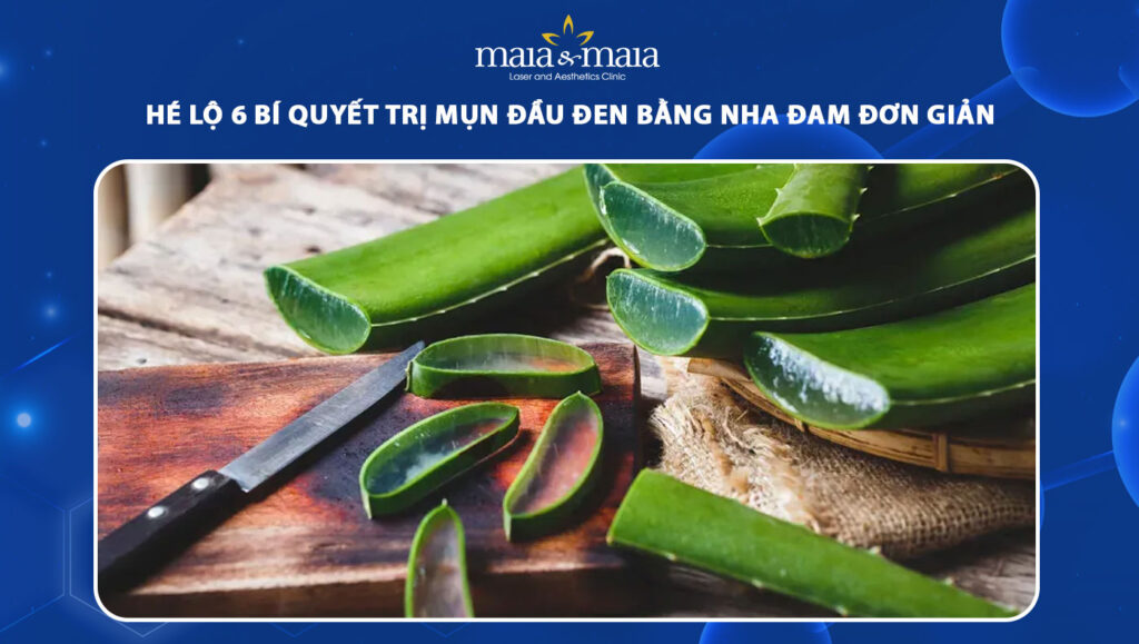 trị mụn đầu đen bằng nha đam