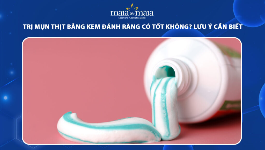 trị mụn thịt bằng kem đánh răng