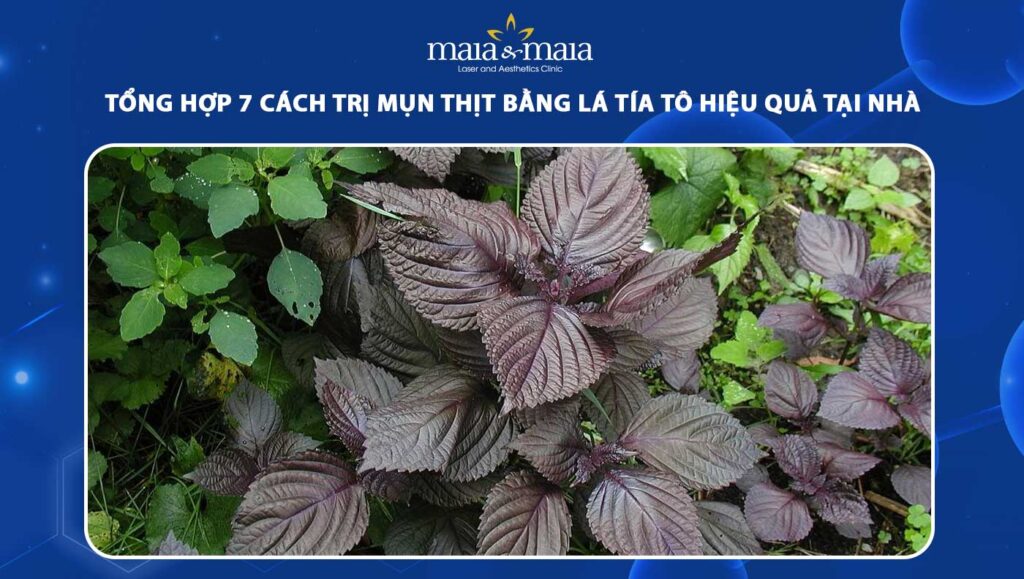 trị mụn thịt bằng lá tía tô