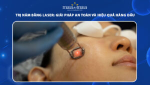 trị nám bằng laser