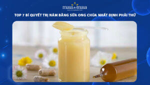 trị nám bằng sữa ong chúa